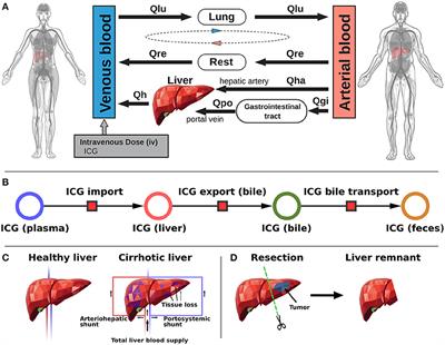 Prediction of Survival After Partial Hepatectomy Using a Physiologically Based Pharmacokinetic Model of Indocyanine Green Liver Function Tests